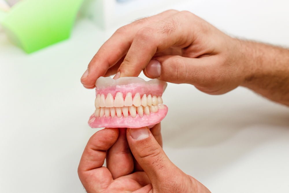 Implante dentário: o que é, quando é indicado e como é feito 5